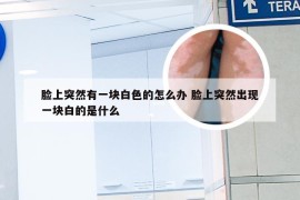 脸上突然有一块白色的怎么办 脸上突然出现一块白的是什么