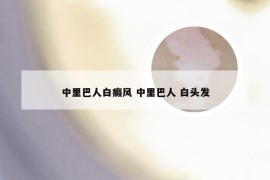 中里巴人白癜风 中里巴人 白头发