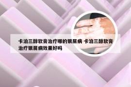卡泊三醇软膏治疗哪的银屑病 卡泊三醇软膏治疗银屑病效果好吗