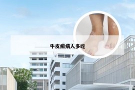 牛皮癣病人多吃