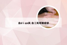 白dⅰαn风 白廯风早期症状