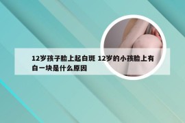 12岁孩子脸上起白斑 12岁的小孩脸上有白一块是什么原因