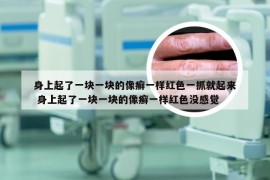 身上起了一块一块的像癣一样红色一抓就起来 身上起了一块一块的像癣一样红色没感觉