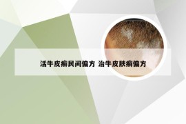 活牛皮癣民间偏方 治牛皮肤癣偏方