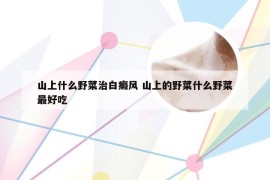 山上什么野菜治白癜风 山上的野菜什么野菜最好吃