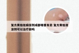 复方黄柏祛癣搽剂成都哪里有卖 复方黄柏液涂剂可以治疗藓吗