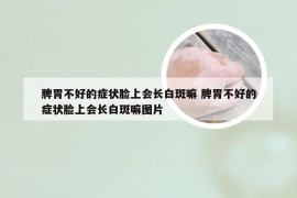 脾胃不好的症状脸上会长白斑嘛 脾胃不好的症状脸上会长白斑嘛图片