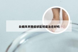 白癜风早期症状能彻底治愈好吗