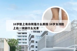 16岁脸上有白斑是什么原因 16岁女孩脸上白一块缺什么元素