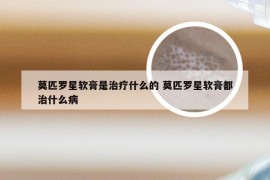 莫匹罗星软膏是治疗什么的 莫匹罗星软膏都治什么病