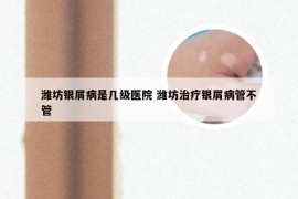 潍坊银屑病是几级医院 潍坊治疗银屑病管不管