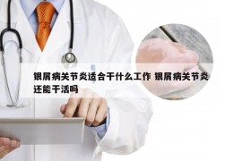 银屑病关节炎适合干什么工作 银屑病关节炎还能干活吗