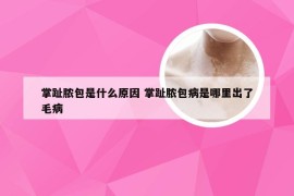 掌趾脓包是什么原因 掌趾脓包病是哪里出了毛病