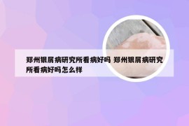 郑州银屑病研究所看病好吗 郑州银屑病研究所看病好吗怎么样