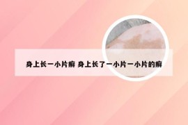 身上长一小片癣 身上长了一小片一小片的癣