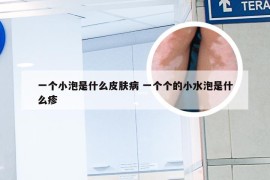 一个小泡是什么皮肤病 一个个的小水泡是什么疹