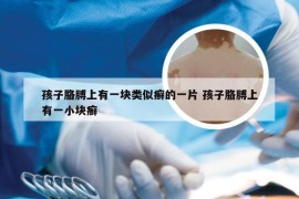 孩子胳膊上有一块类似癣的一片 孩子胳膊上有一小块癣