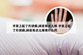 手背上起了片状癣,掉皮有点儿痒 手背上起了片状癣,掉皮有点儿痒用什么药