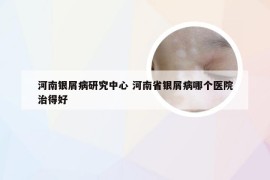 河南银屑病研究中心 河南省银屑病哪个医院治得好