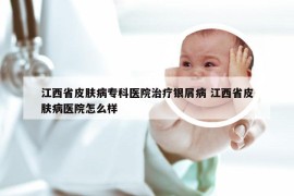江西省皮肤病专科医院治疗银屑病 江西省皮肤病医院怎么样
