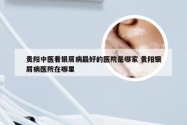 贵阳中医看银屑病最好的医院是哪家 贵阳银屑病医院在哪里