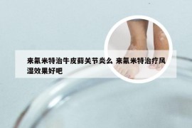 来氟米特治牛皮藓关节炎么 来氟米特治疗风湿效果好吧