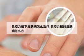 免疫力低下皮肤病怎么治疗 免疫力低的皮肤病怎么办