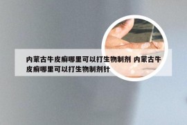 内蒙古牛皮癣哪里可以打生物制剂 内蒙古牛皮癣哪里可以打生物制剂针