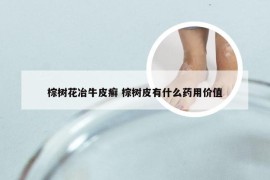 棕树花冶牛皮癣 棕树皮有什么药用价值