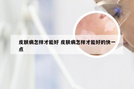 皮肤病怎样才能好 皮肤病怎样才能好的快一点