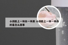 小孩脸上一块白一块黑 小孩脸上一块一块白的是怎么回事