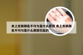 身上皮肤颜色不均匀是什么原因 身上皮肤颜色不均匀是什么原因引起的