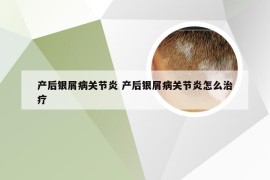 产后银屑病关节炎 产后银屑病关节炎怎么治疗