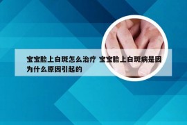 宝宝脸上白斑怎么治疗 宝宝脸上白斑病是因为什么原因引起的