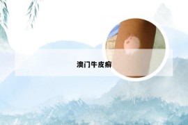 澳门牛皮癣