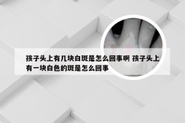 孩子头上有几块白斑是怎么回事啊 孩子头上有一块白色的斑是怎么回事