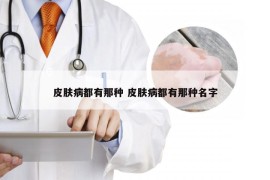 皮肤病都有那种 皮肤病都有那种名字