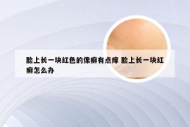 脸上长一块红色的像癣有点痒 脸上长一块红癣怎么办