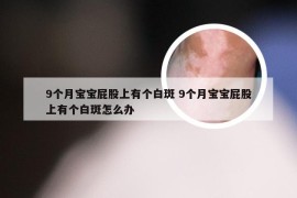 9个月宝宝屁股上有个白斑 9个月宝宝屁股上有个白斑怎么办