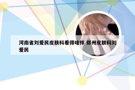 河南省刘爱民皮肤科看得啥样 郑州皮肤科刘爱民