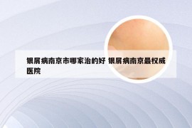 银屑病南京市哪家治的好 银屑病南京最权威医院