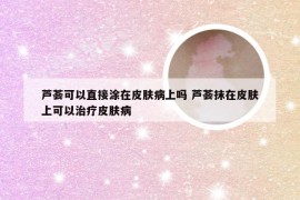 芦荟可以直接涂在皮肤病上吗 芦荟抹在皮肤上可以治疗皮肤病