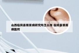 山西临猗县银屑病研究所怎么样 临猗县银屑病医院