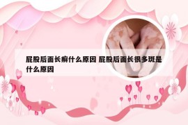 屁股后面长癣什么原因 屁股后面长很多斑是什么原因