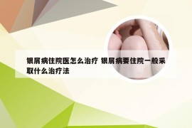 银屑病住院医怎么治疗 银屑病要住院一般采取什么治疗法