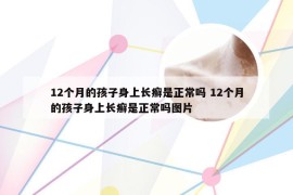 12个月的孩子身上长癣是正常吗 12个月的孩子身上长癣是正常吗图片