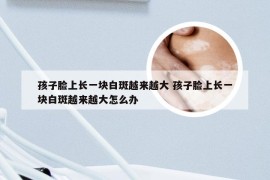 孩子脸上长一块白斑越来越大 孩子脸上长一块白斑越来越大怎么办
