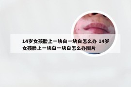 14岁女孩脸上一块白一块白怎么办 14岁女孩脸上一块白一块白怎么办图片