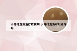 小苏打洗澡治疗皮肤病 小苏打洗澡可以止痒吗