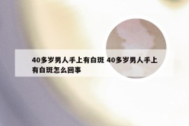 40多岁男人手上有白斑 40多岁男人手上有白斑怎么回事